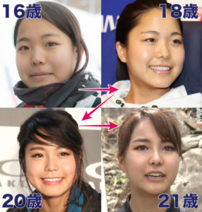 高梨沙羅と言えばイモトアヤコ似じゃありませんでした ｋ ｐｏｐの連中 Yahoo 知恵袋