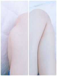 正座ですが 私は足のむくみが原因なのかどうかわわかりませんが 正座ができま Yahoo 知恵袋