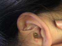 過ぎ 耳かき し 高齢者の耳掃除はどうやってすればいい？耳垢がたまりやすい高齢者の耳かきの仕方