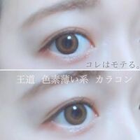 アイプチをして平行二重を作ってもどうしてもきれいなカーブになりません こんに Yahoo 知恵袋