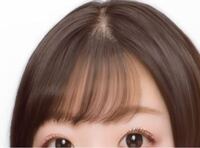 前髪のてっぺんハゲについて 前髪のてっぺんがとても薄いです 私は毛が細い Yahoo 知恵袋