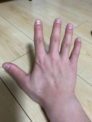手の甲は一般的な男性と同じサイズなのに 指だけかなり短いんです 関節が Yahoo 知恵袋