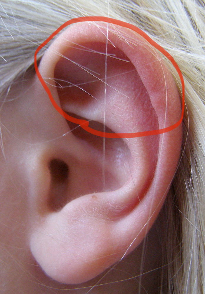 耳の病気 解決済みの質問 Yahoo 知恵袋