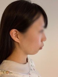 整形についてご質問 フェイスラインを綺麗にするために自分の横顔を撮 Yahoo 知恵袋