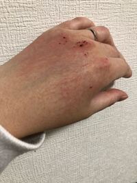 産まれたばかりの赤ちゃんがいます 生後1週間 もともと手荒れする方でし Yahoo 知恵袋