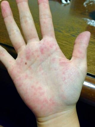 最も欲しかった 手足 小さい 手足 小さい 骨格