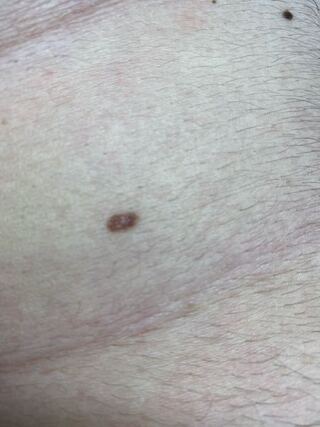 手数料 地下鉄 天井 お腹 ほくろ たくさん Hokensoudan Osaka Jp