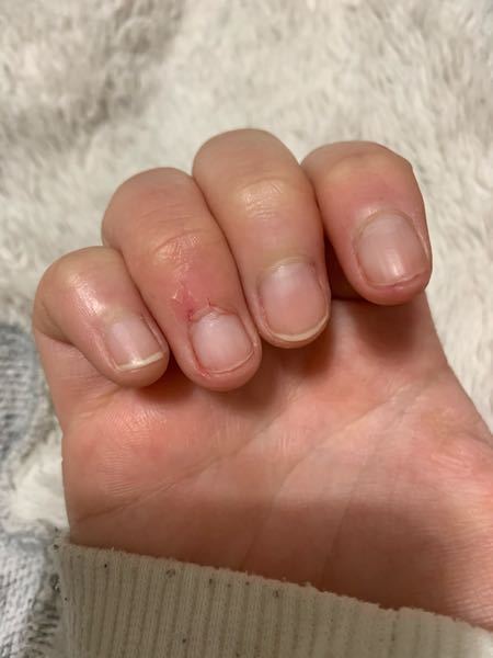 閲覧注意です 甘皮処理をしてもあんまりうまく出来なくていつも皮 Yahoo 知恵袋