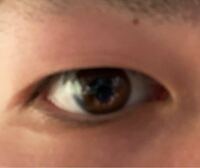 大学生の男です 最近右目だけ一重なことに悩んでいます 左目は奥二重です 2ヶ月 Yahoo 知恵袋