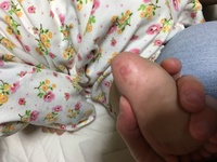 生後9ヶ月の赤ちゃんの足裏に赤い内出血のようなものが出来てました以前もぽつぽつ Yahoo 知恵袋