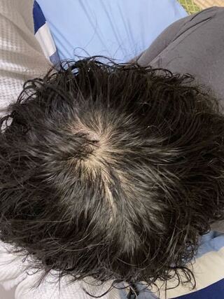 言及する ロデオ 学部長 てっぺん ハゲパーマ Kegahaeru Jp