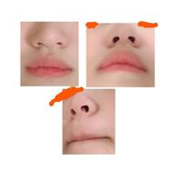 鼻プチってドラッグストア等で買うことできますか そんな商品を販売した Yahoo 知恵袋