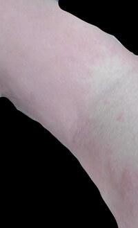 身体中がかゆいです 顔から足まで全部かゆくてかゆくてかきまくってしまいます 昨 Yahoo 知恵袋