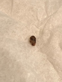 これはダニの抜け殻でしょうか 大きさは3ミリくらいです Yahoo 知恵袋