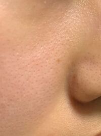 化粧ノリが壊滅的に悪いです 画像あり19歳です 肌も汚いのでそこ Yahoo 知恵袋