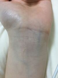 パーソナルカラー診断についてです 血管の色でイエベかブルベかが分かるそう Yahoo 知恵袋