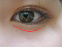 涙袋の線はくっきりありますが全く膨らんでおらず平たいです 笑うとぷくっと Yahoo 知恵袋