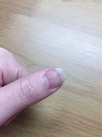 高校生の女子です 1年ほど前からなのですが 爪の中に黒い線があります 特 Yahoo 知恵袋