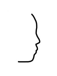 歯列矯正について質問です 画像は私の横顔をイラストにしたもの Yahoo 知恵袋