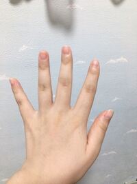 短太い手の写真があります 苦手な方は見るのを控えてください 私の手は人よ Yahoo 知恵袋