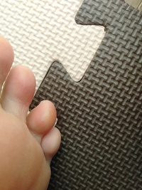 足の指の変形の治し方子供の頃から足を付いた時に両足の薬指と小指が内側に曲がりま Yahoo 知恵袋