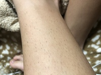 中学生です すね毛の生え方が髭みたいなんですけど もう少し伸びればツ Yahoo 知恵袋