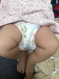 赤ちゃんの股関節脱臼について 生後3ヶ月の娘がいます2歳の息子もいて4ヶ Yahoo 知恵袋