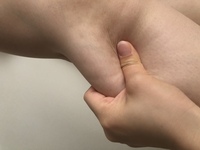 太もものお肉をつまむとデコボコがヤバいです どうしたら なおりますか 29歳 Yahoo 知恵袋