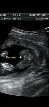 印刷 妊娠5月性別 女の子