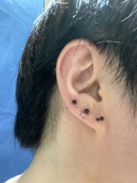 オロナイン軟膏を付けたまま紫外線を浴びると日焼けするらしいですが Yahoo 知恵袋