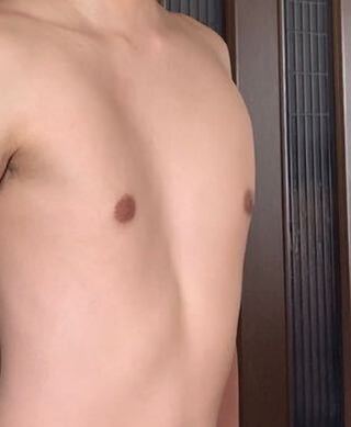 筋 トレ 胸 漏斗