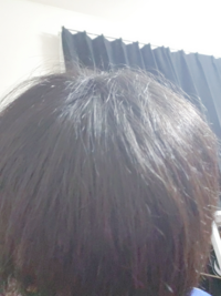 なくす アホ 毛