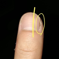 写真を添付してます すみません親指をいじる癖があります 無意識に Yahoo 知恵袋