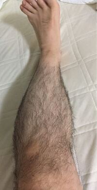 男で毛深いのですが これからの暑い時期は短パンからスネ毛が見えたり シャツの胸 Yahoo 知恵袋