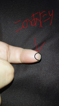 左手の人差し指の先がズキズキ痛いです 爪と指先の間で右手の爪で Yahoo 知恵袋