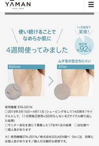光美容器レイボーテについての質問です 家庭用脱毛器 説明書には目安 Yahoo 知恵袋