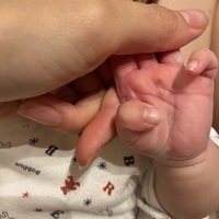 どなたか至急お願いします 生後1ヶ月の赤ちゃんの手のひらに黒い斑点がありました Yahoo 知恵袋