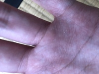 手相の太陽環のことなんですが 最近出てきました しかも二重にな Yahoo 知恵袋