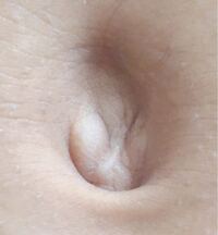 女子です おへその画像なのですが 変ですか また このおへそ Yahoo 知恵袋