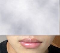 19歳の男です これってたらこ唇ですかね 唇熱いのがコンプレックスなんで Yahoo 知恵袋