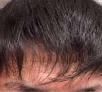 高校生です 写真の前髪って薄いですよね これでも精一杯前髪集 Yahoo 知恵袋