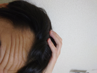 若ハゲについて こんにちは私は18歳の大学生なんですが最近ハゲて Yahoo 知恵袋