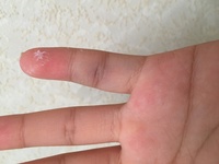 バスケ部なのですが今日部活で突き指をしました 突き指が初めてなので早く治す方法 Yahoo 知恵袋