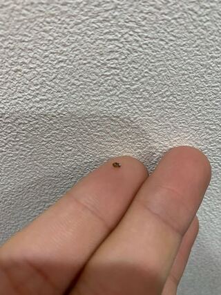 グロ注意背中にポツっとしたものがあって押し出して見たらこれが出てきま Yahoo 知恵袋