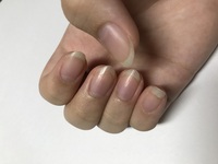 元々 天然で 爪が綺麗な人ってなぜキレイなんですか 遺伝です Yahoo 知恵袋