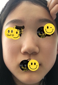 おでこ ほっぺなどのニキビが治りません オロナイン塗ってます Yahoo 知恵袋