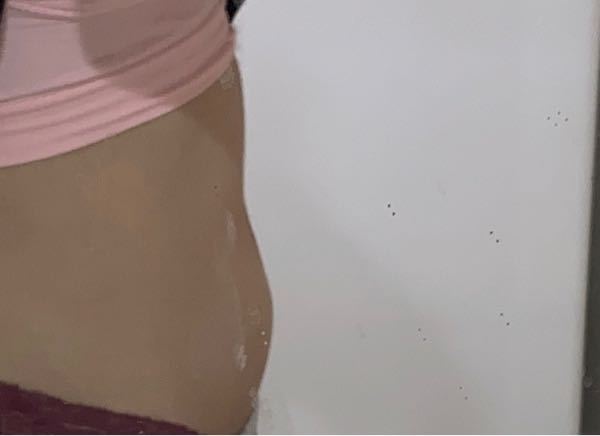 コイン100枚です 至急なのでお願いします 卵巣腫瘍お腹ぽっこり画像汚く Yahoo 知恵袋