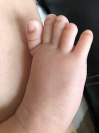 生後2ヶ月の赤ちゃんです 足の薬指が短く 小指のほうが長く見えます 何かの Yahoo 知恵袋