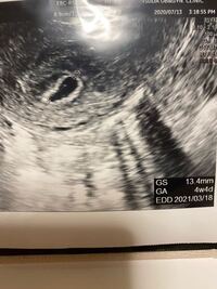 6w1dで今日病院に行き 胎嚢は確認できたのですが 心拍は確認で Yahoo 知恵袋