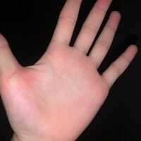 生命線がほんとにないんですけど 生命線と寿命って関係ありますかね ま Yahoo 知恵袋